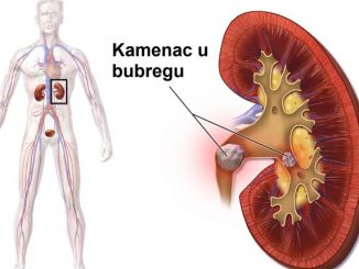 kamenac u bubregu