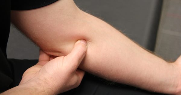 goruća bol u laktu lijeve ruke bol u ramenskom zglobu liječenje cervikalne osteohondroze