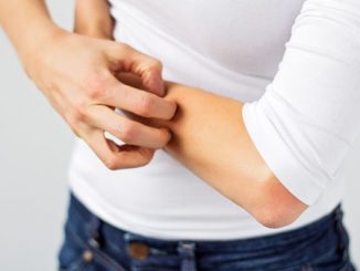neurodermatitis